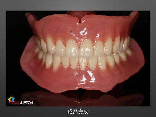 成人补牙流程图解视频,轻松了解每一步操作